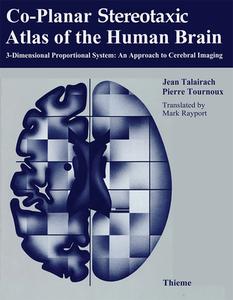 Co-Planar Stereotaxic Atlas of the Human Brain di Jean Talairach, Pierre Tournoux edito da Thieme Georg Verlag
