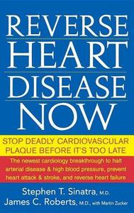 Reverse Heart Disease Now: Stop Deadly Cardiovascular Plaque Before It's Too Late di Stephen T. Sinatra, James C. Roberts edito da WILEY