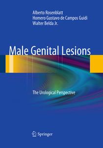 Male Genital Lesions di Alberto Rosenblatt, Homero Gustavo de Campos Guidi, Walter Belda Jr. edito da Springer-verlag Berlin And Heidelberg Gmbh & Co. Kg