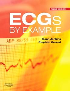 Ecgs By Example di DEAN JENKINS edito da Elsevier Hs 010a