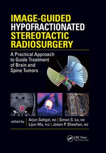 Image-guided Hypofractionated Stereotactic Radiosurgery edito da Taylor & Francis Ltd