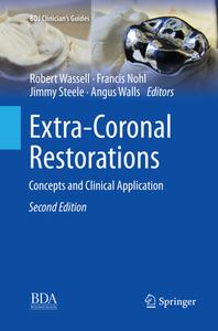 Extra-coronal Restorations edito da Springer Nature Switzerland Ag