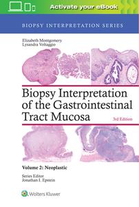 Biopsy Interpretation of the Gastrointestinal Tract Mucosa: Volume 2: Neoplastic di Elizabeth A. Montgomery, Lysandra Voltaggio edito da Lippincott Williams&Wilki