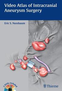 Video Atlas of Intracranial Aneurysm Surgery di Eric Nussbaum edito da Thieme Georg Verlag