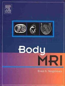Body Mri di Evan S. Siegelman edito da Elsevier Health Sciences