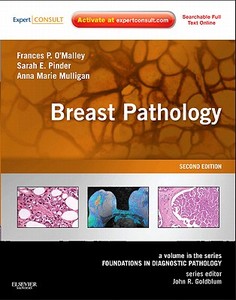 Breast Pathology di Frances P. O'Malley, Sarah E. Pinder, Anne Marie Mulligan edito da Elsevier Health Sciences