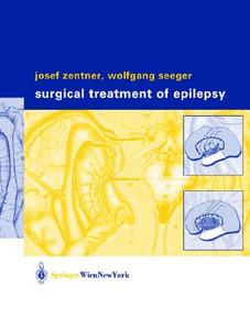 Surgical Treatment of Epilepsy di Josef Zentner, Wolfgang Seeger, Zentner edito da Springer