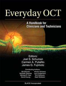 Everyday Oct di Joel S. Schuman, Carmen A. Puliafito, James G. Fujimoto edito da Slack Incorporated