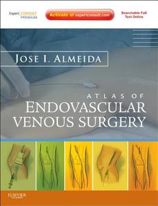 Atlas Of Endovascular Venous Surgery di Jose Almeida edito da Elsevier Health Sciences