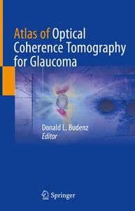 Atlas of Optical Coherence Tomography for Glaucoma edito da Springer International Publishing