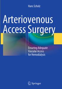 Arteriovenous Access Surgery di Hans Scholz edito da Springer-verlag Berlin And Heidelberg Gmbh & Co. Kg