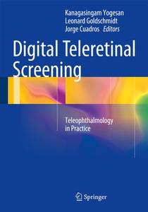 Digital Teleretinal Screening edito da Springer-Verlag GmbH