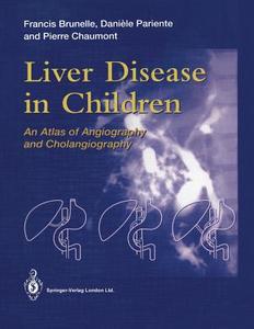 Liver Disease in Children di Francis Brunelle, Pierre Chaumont, Daniele Pariente edito da Springer London