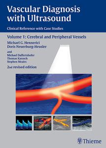 Vascular Diagnosis With Ultrasound di Michael G. Hennerici, Doris Neuerburg-Heusler edito da Thieme Publishing Group
