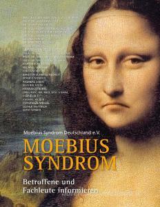 Moebius Syndrom edito da Books on Demand
