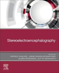 Stereoelectroencephalography edito da ELSEVIER
