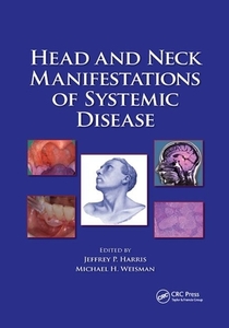 Head And Neck Manifestations Of Systemic Disease edito da Taylor & Francis Ltd