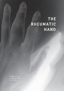The Rheumatic Hand di Raphael Micheroli, Giorgio Tamborrini, Diego Kyburz edito da Books on Demand