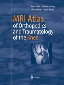 MRI Atlas of Orthopedics and Traumatology of the Knee di Peter Hertel, Hermann König, Peter Teller, Ulrich Weber edito da Springer Berlin Heidelberg