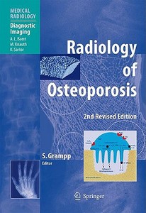 Radiology Of Osteoporosis edito da Springer-verlag Berlin And Heidelberg Gmbh & Co. Kg