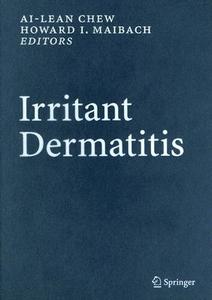 Irritant Dermatitis edito da Springer-verlag Berlin And Heidelberg Gmbh & Co. Kg