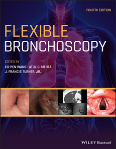 Flexible Bronchoscopy 4th Edition di WANG edito da Wiley