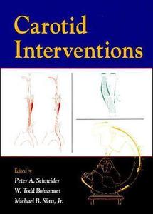 Carotid Interventions di Schneider, Peter A. Schneider, W. Todd Bohannon edito da Taylor & Francis Inc