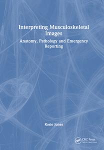 Interpreting Musculoskeletal Images di Rosie Jones edito da Taylor & Francis Ltd