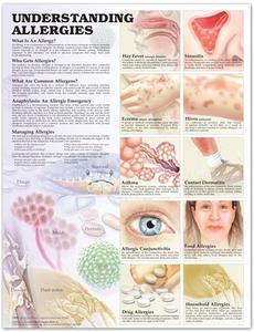 Understanding Allergies Anatomical Chart edito da Anatomical Chart Co.