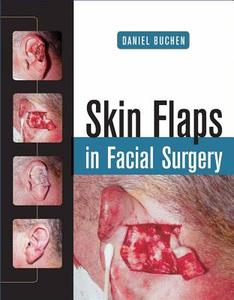 Skin Flaps In Facial Surgery di Daniel Buchen edito da Mcgraw-hill Education - Europe
