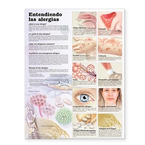 Understanding Allergies Anatomical Chart In Spanish (entendiendo Las Alergias) edito da Anatomical Chart Co.
