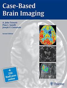 Case-Based Brain Imaging di A. John Tsiouris, Joseph Communale, Pina Sanelli edito da Thieme Georg Verlag