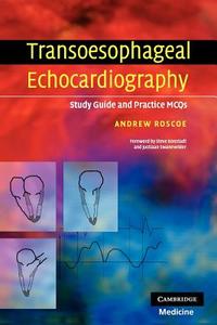 Transoesophageal Echocardiography di Andrew Dr Roscoe edito da Cambridge University Press