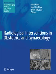 Radiological Interventions In Obstetrics And Gynaecology edito da Springer-verlag Berlin And Heidelberg Gmbh & Co. Kg