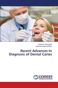 Recent Advances In Diagnosis of Dental Caries di Krishnan Venugopal, KrishnaPrasad Lashkari edito da LAP Lambert Academic Publishing