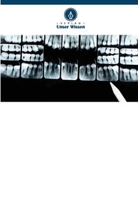 Wurzelresorption di Nimisha N. Mahajan, Rohit Dhoot, Snehal Palwe edito da Verlag Unser Wissen