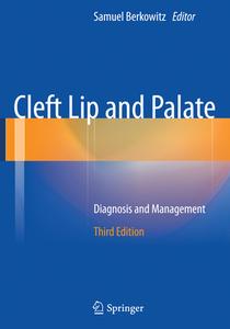 Cleft Lip And Palate edito da Springer-verlag Berlin And Heidelberg Gmbh & Co. Kg