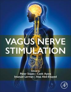 Vagus Nerve Stimulation edito da ACADEMIC PR INC